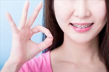 Phương pháp niềng răng phù hợp cho tuổi thanh, thiếu niên